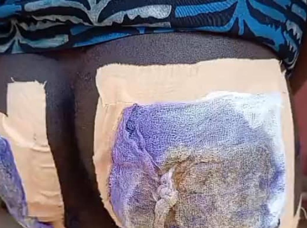 Teenager in critical condition after alleged abusive attack by father of ex-girlfriend