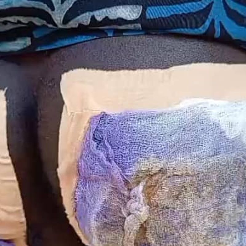 Teenager in critical condition after alleged abusive attack by father of ex-girlfriend