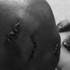 Developer attacked by armed landguards in Gomoa Tuansah